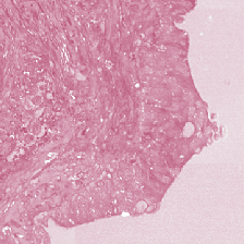 Histologický H&E obraz separovaného eosinu 4