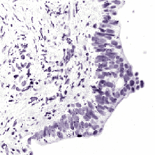 Histologický H&E obraz separovaného hematoxylinu 4